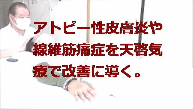 アトピー性皮膚炎や線維筋痛症を本物の気功師に優る天啓気療で改善に導く