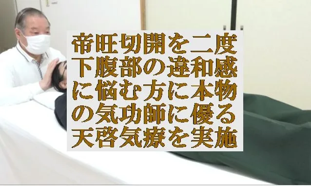 帝旺切開を二度,下腹部の違和感に本物の気功師,遠隔に優る天啓気療を実施