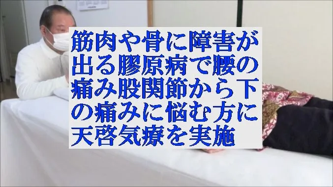 筋肉や骨に障害が出る膠原病で腰痛,特に股関節から下の痛みに天啓気療を実施